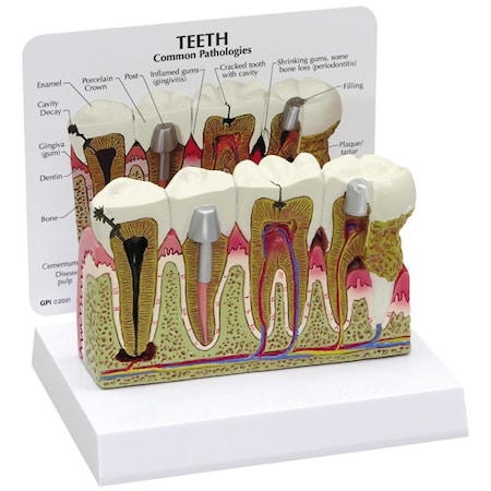 Anatomical Model - Teeth